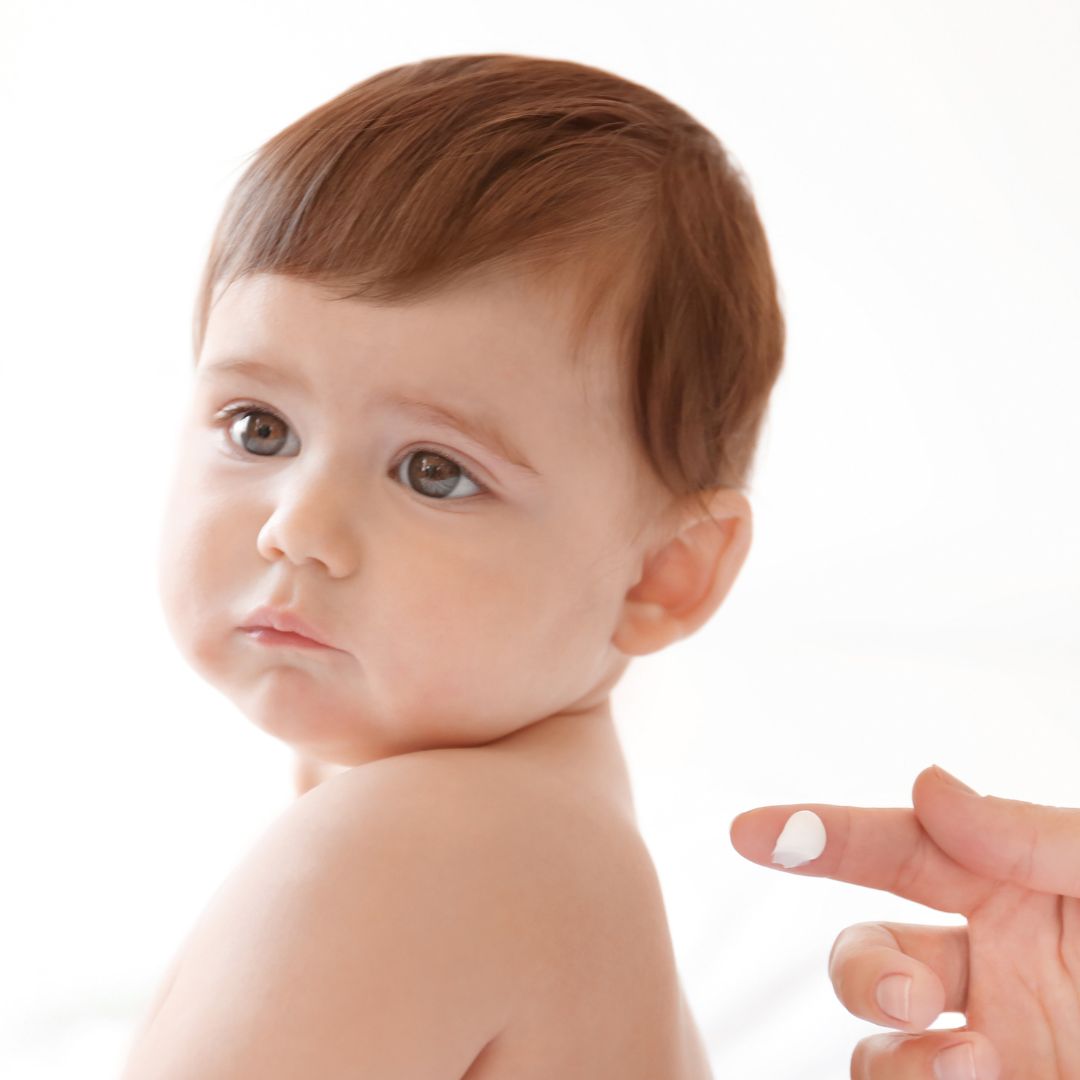 How Often Should You Moisturise Eczema-Prone Skin?